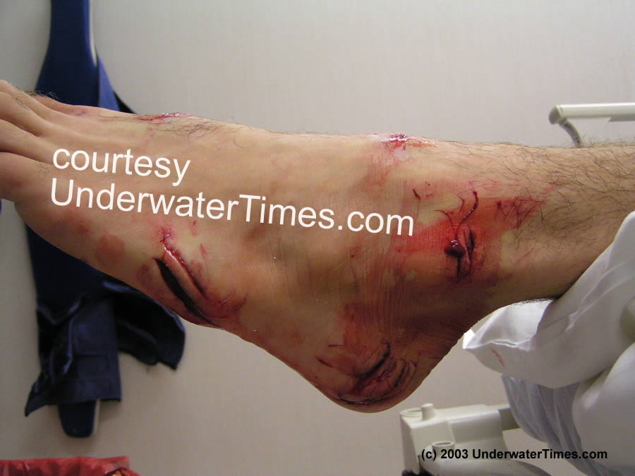 up with the Shark Attacks? shark attacks in florida. up with the Shark Attacks?