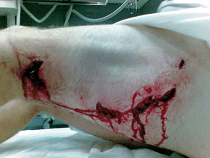 great white shark attack leg wound south africa