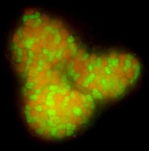 Archaea in the picture in red,