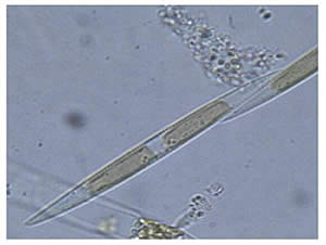 Pseudo nitschia cells