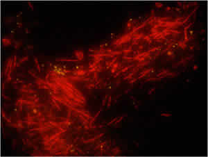 clump Pseudo nitschia cells