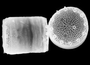 diatoms