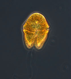 dinoflagellate
