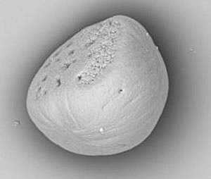 otolith electron microscope