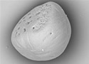 otolithelectronmicroscopesm