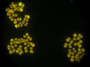 unidentified cyanobacteria