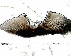 banded morwong otolith