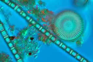 diatom