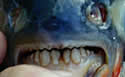 fishteeth