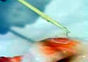 salmonworm