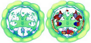 virtual Platynereis brain