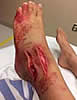 bloodyfootfish